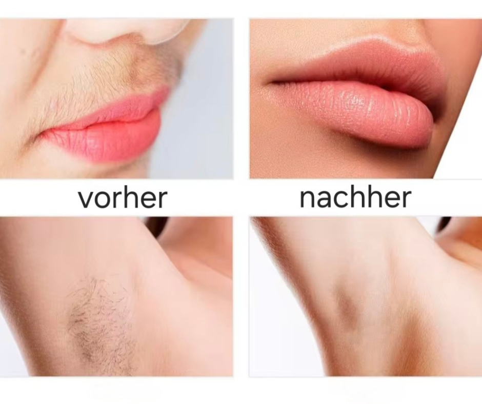 Elektrischer Epilierer Gesichts-Augenbrauentrimmer